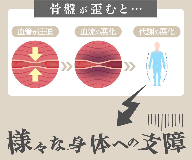 骨盤が歪むと…血管が圧迫、血流の悪化、代謝の悪化、様々な身体への支障